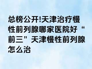 总榜公开!天津治疗慢性前列腺哪家医院好“前三”天津慢性前列腺怎么治