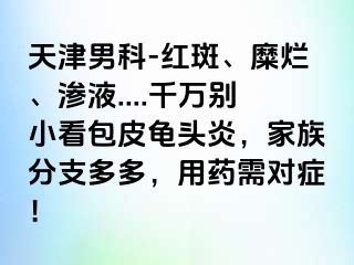 天津男科-红斑、糜烂、渗液....千万别小看包皮龟头炎，家族分支多多，用药需对症！
