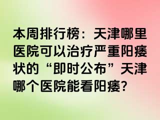本周排行榜：天津哪里医院可以治疗严重阳痿状的“即时公布”天津哪个医院能看阳痿？